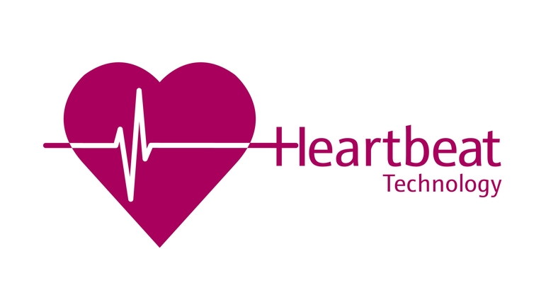 Технология Heartbeat Технология Heartbeat